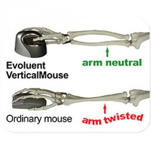 Evoluent VerticalMouse 4 Small Mouse Alternate-Image1/500